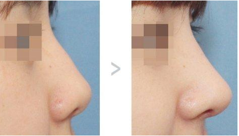 ������ǳC���ăɷN���g��ʽ������ 