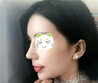 ��ǳC�����gЧ��ǰ�󌦱�