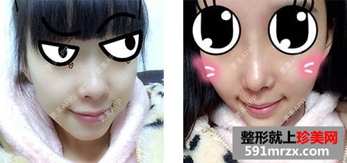 �ǲ�����+�S�°�,¡�ǻ֏�(f��)�^��ǰ�󌦱����˰���Ч����Ƭ�D