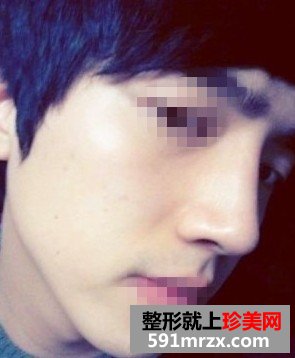 ������¡��ǰ�󌦱ȈD ����׃���ָ���ͦ