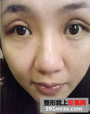 ���p��Ƥ���g�֏͕r�g����5��