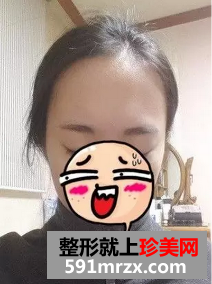 �Nֲ�^�lǰ��Ч��չʾ �Nֲ�^�l��������