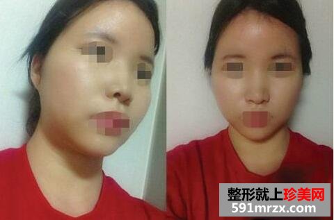 3D���D(zhu��n)�E�ǹ��z¡���������g(sh��)�挍�������·���