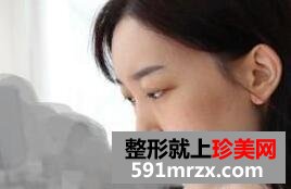 �׸����B��ӛ �沿�������gǰ�󌦱���