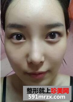 �׸����B��ӛ �沿�������gǰ�󌦱���