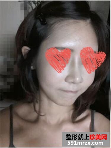 ����¡��+���w֬������沿���R׃��Ԫ����Ů~