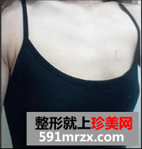�����˴�̎��l�����w֬���S����ô�ӣ���l���S�ذ���