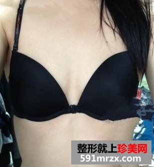 ���w֬����ֲ¡���������gǰ��Ч�����ȈD�ͻ֏��^��