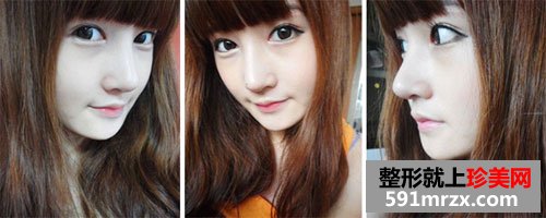 �űȾ��l¡�����gǰ��Ч�����ȈD�ͻ֏��^��