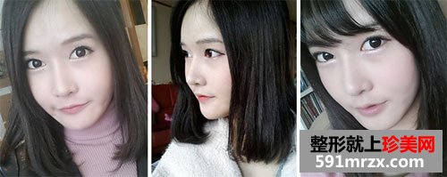 �űȾ��l¡�����gǰ��Ч�����ȈD�ͻ֏��^��