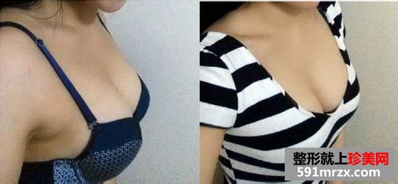 ���w¡��ǰ��֏�Ч�����ȈD