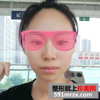 ����Ęᘳ�ҧ��ǰ��Ч�����ȈD�ͻ֏��^��