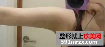 ˮ������֬���ֱ۰���Ч���D