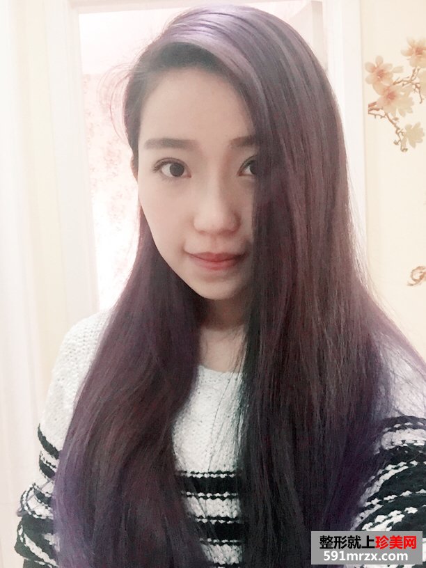 ע����Ę���Ę���Æ᣿��������ǰ�󌦱�Ч���DƬ�ͻ֏��^�̰ɣ�