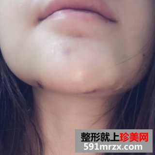 ���w�|�°ͻ֏��^�̈D �������ڼ��w�|�°�