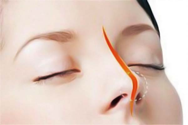 �����I��܊�tԺ������ô�Ӻò��Ãr���